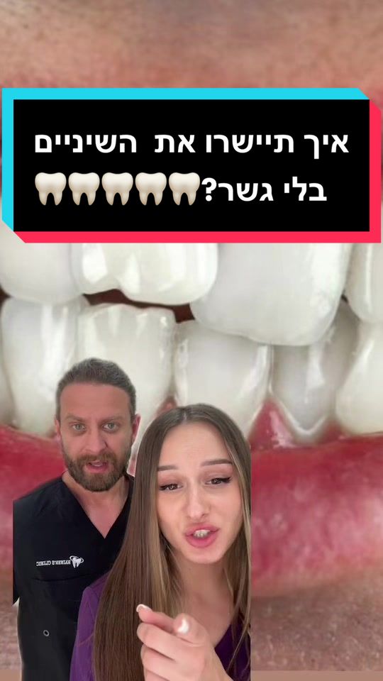 גשר הריאלטו