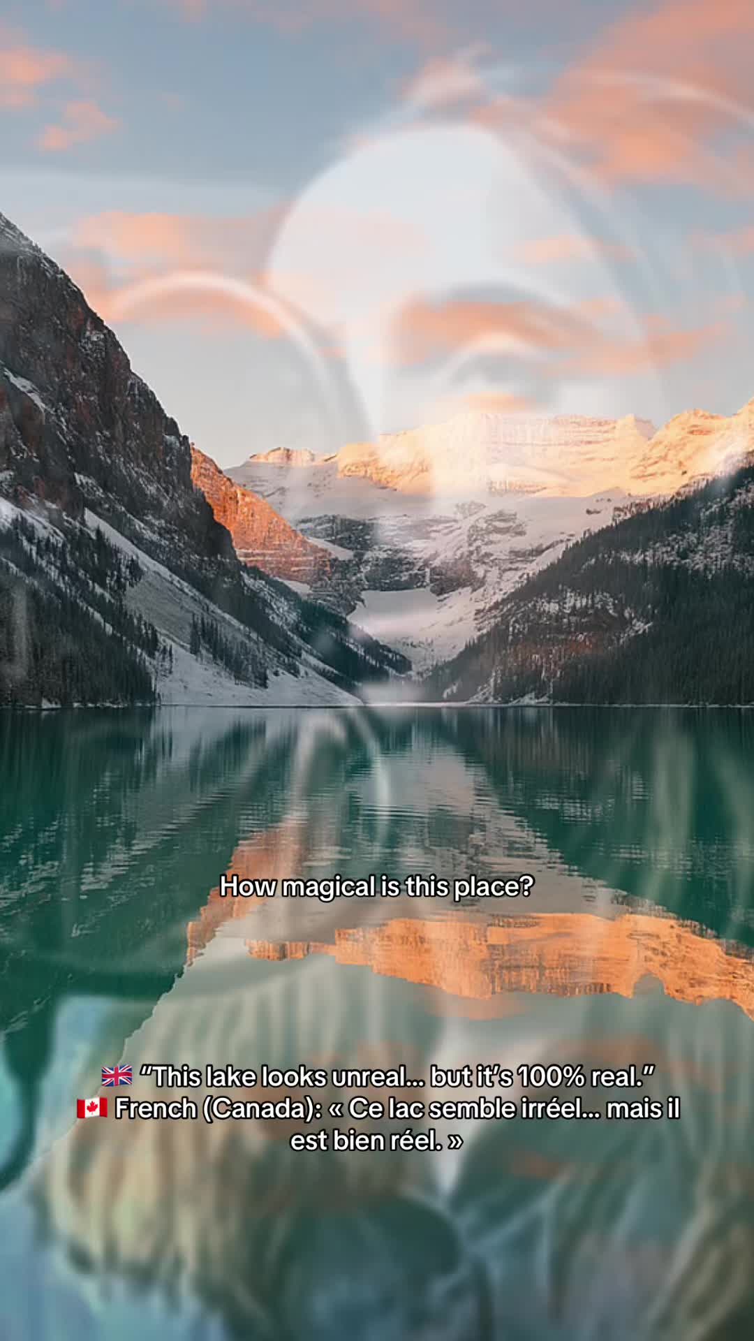 Lake Louise Lakeshore