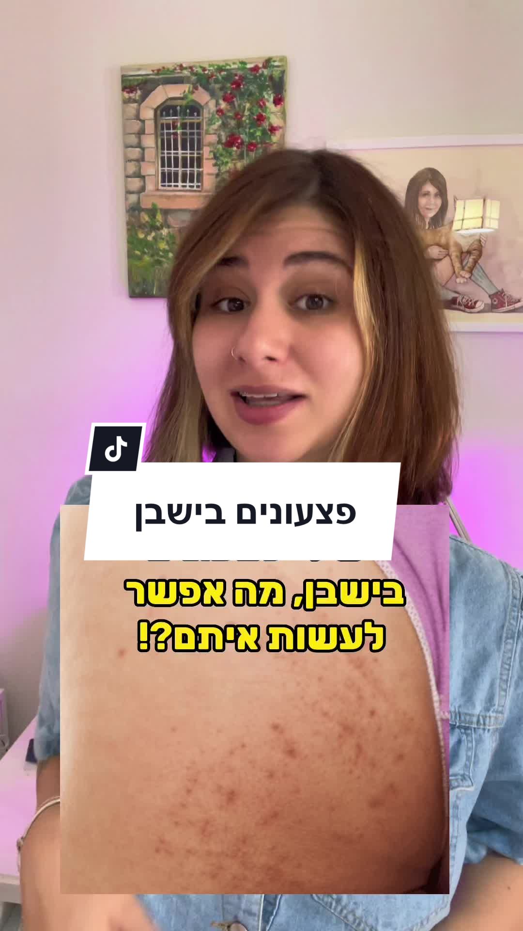 קתדרלת שבע הפצעים